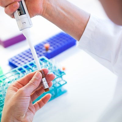 Revolutionize Your Immune Monitoring Assay
